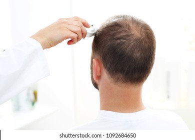 Hair Loss Disease Stock Photos Images Photography Shutterstock