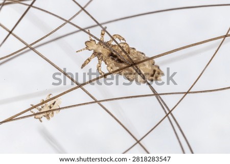 Microscopic close-up of a human head louse (Pediculus humanus capitis) and multiple nits (lice eggs) firmly attached to human hair shafts. The images reveal the morphology of the ectoparasite and its eggs at high magnification, making them suitable for educational, scientific, medical, parasitology, entomology, dermatology, laboratory, and public health applications. Ideal for illustrating head lice infestation, parasite identification, biological research, and microscopy studies.