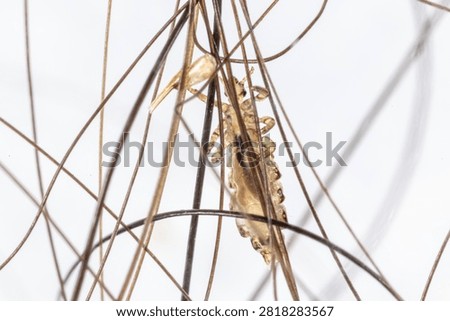 Microscopic close-up of a human head louse (Pediculus humanus capitis) and multiple nits (lice eggs) firmly attached to human hair shafts. The images reveal the morphology of the ectoparasite and its eggs at high magnification, making them suitable for educational, scientific, medical, parasitology, entomology, dermatology, laboratory, and public health applications. Ideal for illustrating head lice infestation, parasite identification, biological research, and microscopy studies.