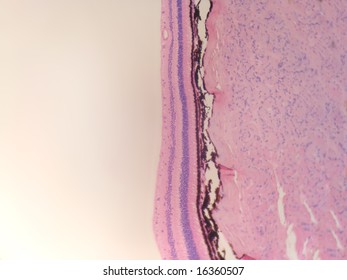 A Microscopic Cross Section Of A Mammalian Retina Showing The Different Layers