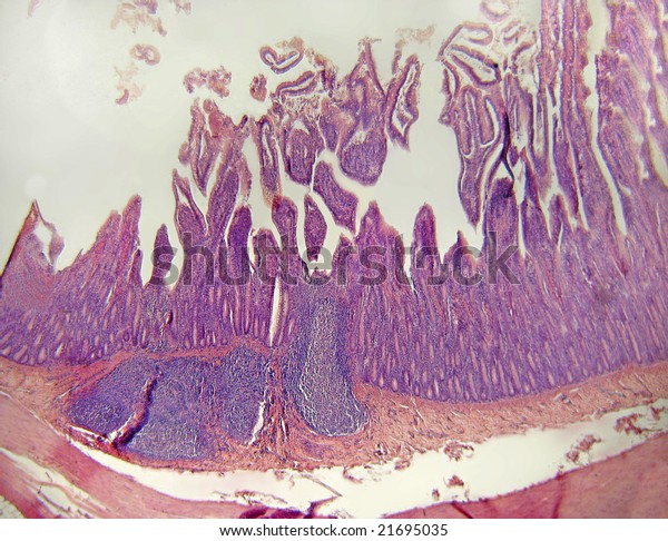 Microscopic Cross Section Wall Ileum Portion Stock Photo (Edit Now ...