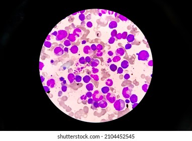 Microscopic Examination Of Bone Marrow.