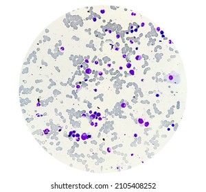 Microscopic Examination Of Bone Marrow Study.