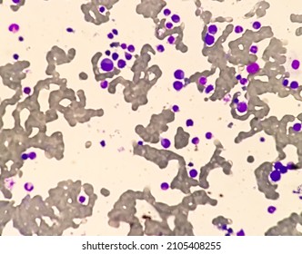 Microscopic Examination Of Bone Marrow Study.