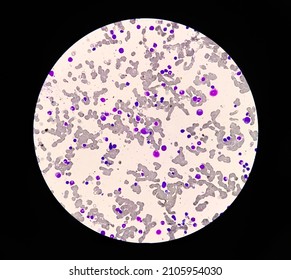 Microscopic Examination Of Bone Marrow Study.