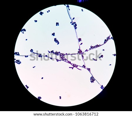 microscopic examination candida albicans found budding stock photo
