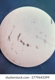Microscopic Examination of Dislodged Moth Wing Scales and Sensory Bristles Specimen