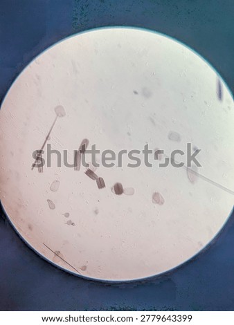 Microscopic Examination of Dislodged Moth Wing Scales and Sensory Bristles Specimen