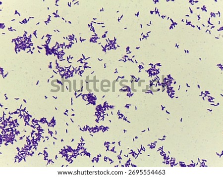 Microscopic Field of Dense, Clumped Bacilli (Rod-Shaped Bacteria) After Gram Staining