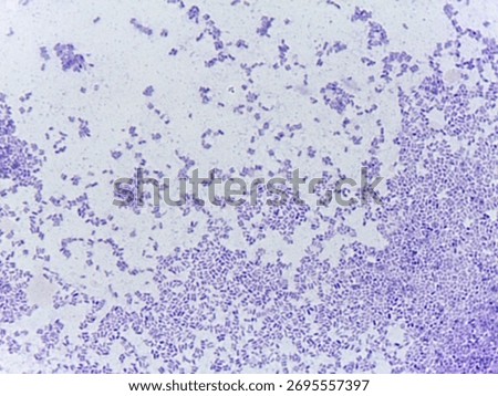 Microscopic Field of Red Pink Bacilli and Dense Bacterial Growth