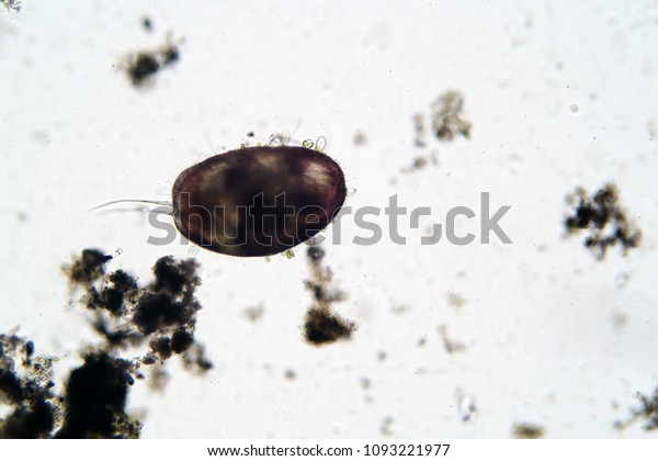 Microscopic\
freshwater Ostracod aka seed shrimp seen through a Microscope at\
100 times its actual size. Taken from a local duck pond of fresh\
water.  Scientific names included\
keywords.