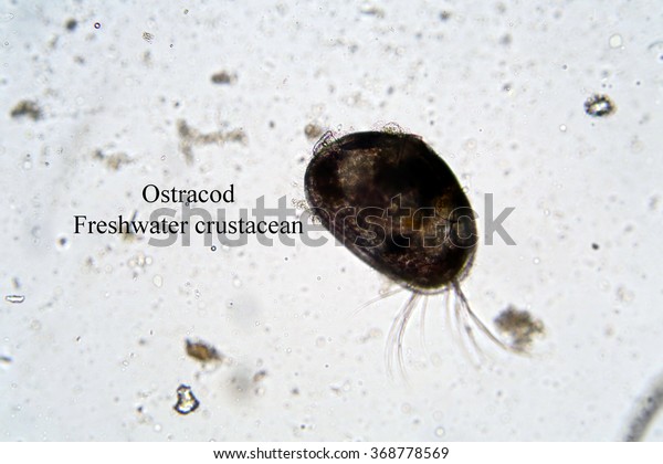 Microscopic freshwater Ostracod aka seed shrimp seen\
through a Microscope at 100 times its actual size. Taken from a\
local duck pond of fresh water. Microscopic life single cell\
animals.\
 