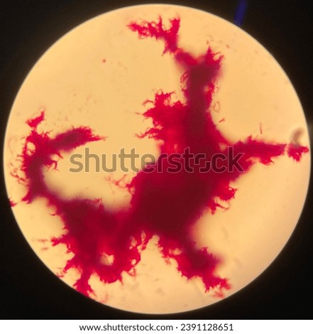 The microscopic image of the cord structure formed by the tuberculosis disease-causing mycobacteria.