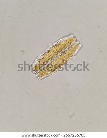 Microscopic image of Epithemia diatom under brightfield, 1000x magnification