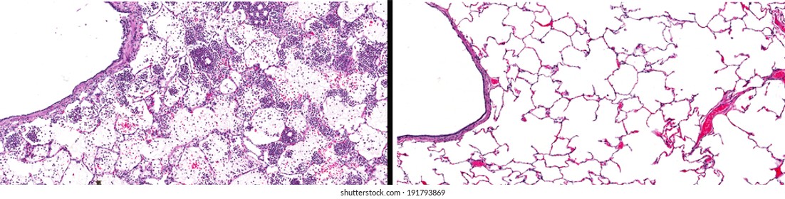 20,379 Microscopic tissue Images, Stock Photos & Vectors | Shutterstock