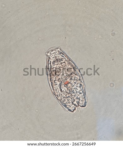 Microscopic image of rotifer Notholca acuminata, 1000x magnification
