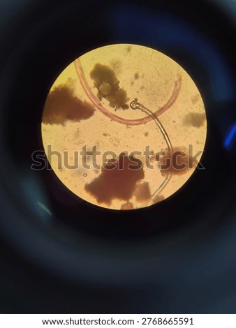 Microscopic image showing a nematode worm observed under a microscope, surrounded by organic debris and particles. This image highlights microbiology research, laboratory analysis, and parasitology concepts.