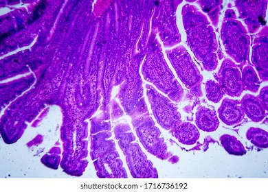 Microscopic Image Of A Small Intestine (cross Section)