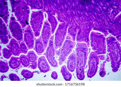 Microscopic Image Of A Small Intestine (cross Section)