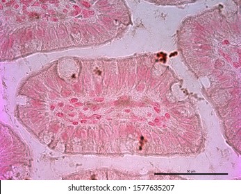 Microscopic image of the small intestine (ileum).