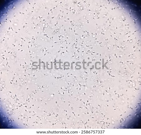 Microscopic image of sperm. Normozoospermia normal sperm count and morphology. 
