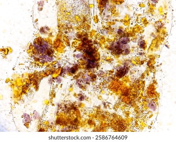 Microscopic image of stool. Vegetable Cells and Starch granules. 