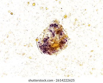 Microscopic image of stool. Vegetable Cells and Starch granules.
