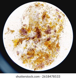 Microscopic image of stool. Vegetable Cells and Starch granules.