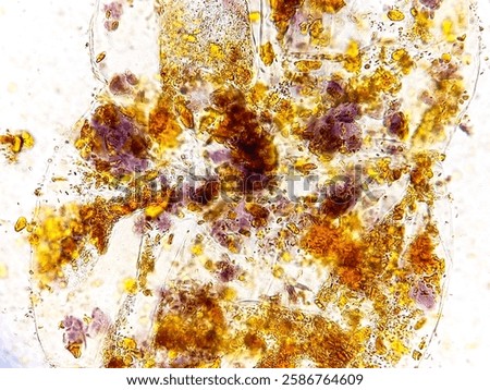 Microscopic image of stool. Vegetable Cells and Starch granules. 