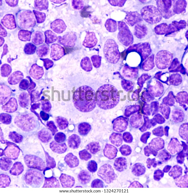 Microscopic Image Touch Prep Cytology Smear Stock Photo 1324270121 ...