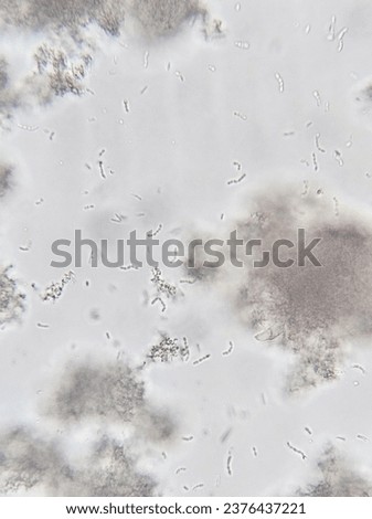 microscopic image of unstained Lactobacillus present in curd under 40 x magnification.it is a friendly bacteria ,doesn't cause disease.this rod shaped bacteria convert milk to curd .