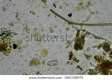 microscopic microorganisms under the microscope