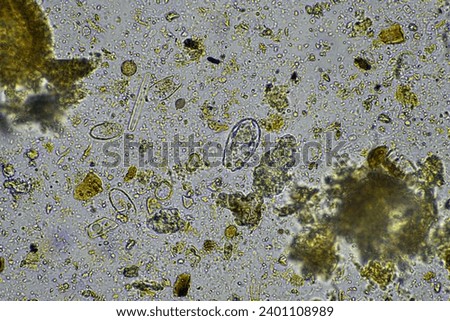 microscopic microorganisms under the microscope