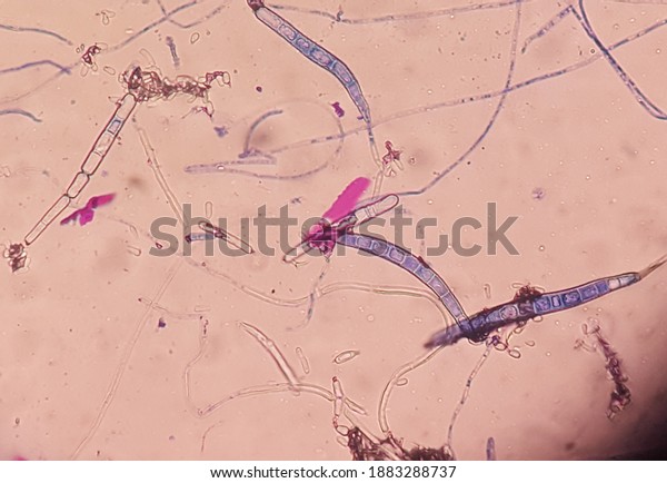 Стоковая фотография 1883288737 Microscopic Morphology Trichophyton