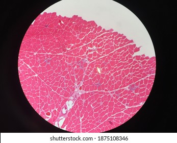 Microscopic Muscle Biopsy Under H And E Staining, Showing Normal Cross Sectional Skeletal Muscle Fiber.