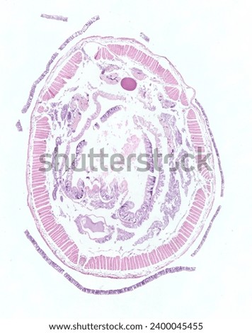 Microscopic observation of a cross-section of an earthworm