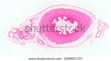 Microscopic observation of a section of the vas deferens