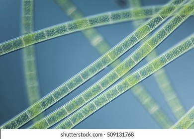 a microscopic organism green algea Spirogyra, focus to cell wall, nucleus, cytoplasm strand, mucilage, vacuole with DIC differential interference contrast, culture material 
