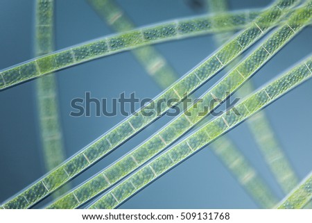 a microscopic organism green algea Spirogyra, focus to cell wall, nucleus, cytoplasm strand, mucilage, vacuole with DIC differential interference contrast, culture material 