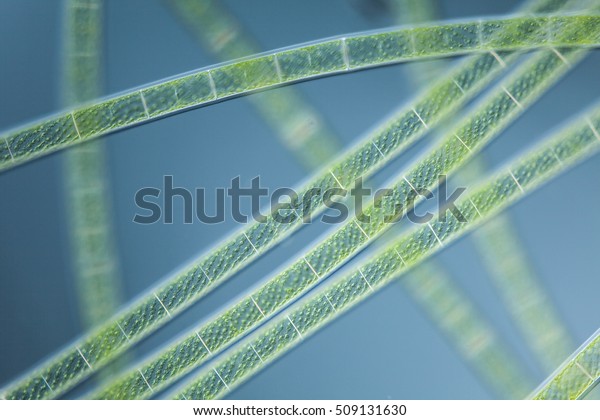 Microscopic Organism Green Algea Spirogyra Focus Stock Photo (Edit Now ...