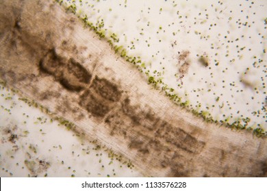 Microscopic Organisms From The Pond. Euglena Gracilis