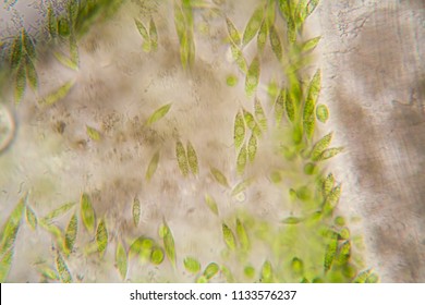 Microscopic Organisms From The Pond. Euglena Gracilis