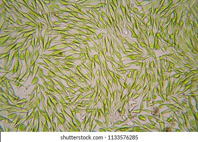 Microscopic Organisms From The Pond. Euglena Gracilis