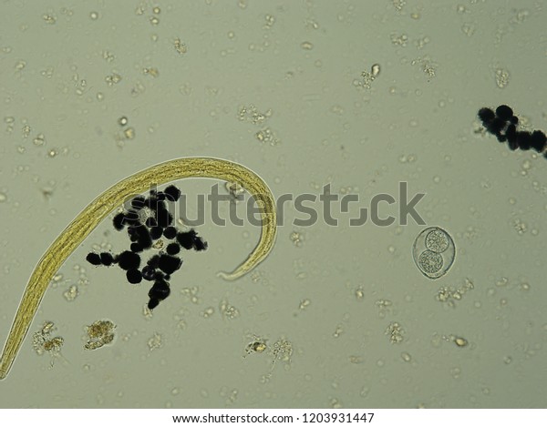Microscopic Parasites >> Microscopic Parasites Cats Stock Photo Edit Now 1203931447 Microscopic Parasites >> Microscopic Parasites Cats Stock Photo Edit Now 1203931447