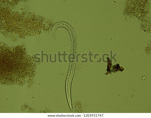 Microscopic Parasites >> Microscopic Parasites Cats Stock Photo Edit Now 1203931747 Microscopic Parasites >> Microscopic Parasites Cats Stock Photo Edit Now 1203931747