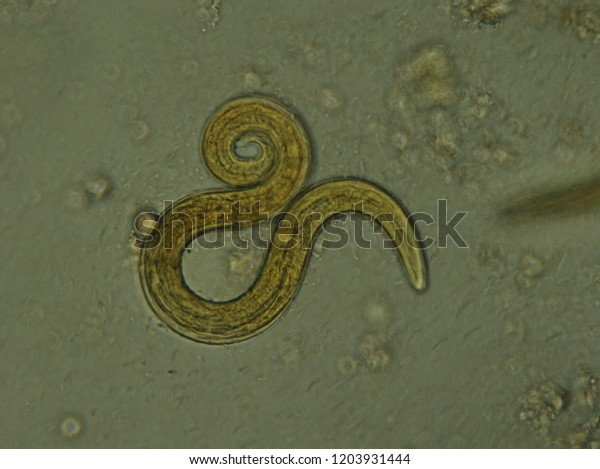 Microscopic Parasites >> Microscopic Parasites Cats Aelurostrongylus Abstrusus Microscopic Parasites >> Microscopic Parasites Cats Aelurostrongylus Abstrusus