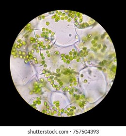 Microscopic photo of cells with chloroplasts in parenchyma of a leaf.
