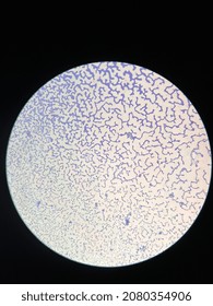 Microscopic Photo Of Gram Positive Bacteria On Slide