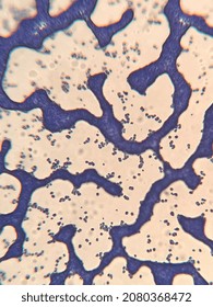 Microscopic Photo Of Gram Positive Bacteria On Slide