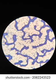 Microscopic Photo Of Gram Positive Bacteria On Slide